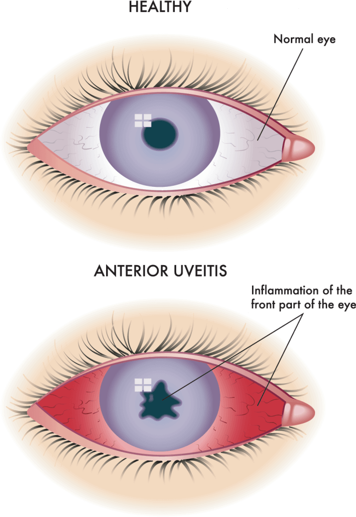 Multidisciplinary care